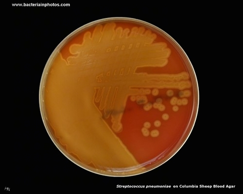 alpha-hemolysis on blood agar